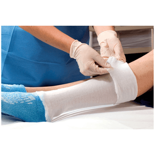 ALBA NON-STERILE STOCKINETTE - Stockinette, 4" x 25 yds, Cotton, 10 rl/cs | Quantity - 1x CS