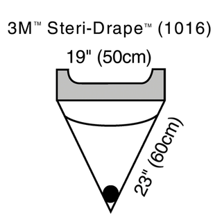 SOLVENTUM STERI-DRAPE IRRIGATION POUCH - Irrigation Pouch, Adhesive Strip & Exit Port, 19" x 23", 10/bx, 4 bx/cs | Quantity - 1x CS